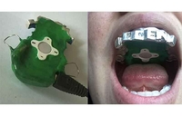 MP3 који се качи на зубе