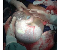 Beba koja nije znala da je rođena: Nastavila da se ponaša kao da je u materici