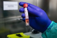 Srbija: Virus korona odnio još dva života