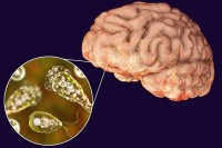 На Флориди издано упозорење због амебе која “једе” мозак