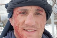 УФЦ борац завршио у болници након што је грешком скочио главом на лед ВИДЕО