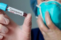 Srbija: Od virus korona preminula 31 osoba, zaraženo 1.325