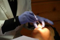 Udahnuo burgiju u pluća tokom popravke zuba VIDEO