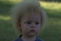 Мали Лав једно од 100 дјеце са синдромом наелектрисане косе