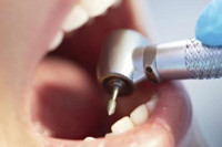 Zubar zaradio milione i dobio zatvor popravljajući zdrave zube