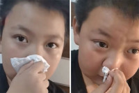 Dječak tvrdi da je alergičan na zadaću, video postao hit VIDEO