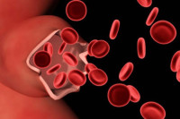 SAD: Odobren lijek protiv hemofilije - koštaće 3,5 miliona dolara