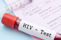 Сутра бесплатно тестирање на ХИВ/АИДС