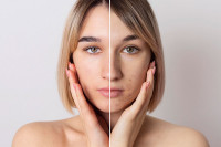 Dermatolog: Pušenje može da izazove nepovratno oštećenje vaše kože, evo 6 najštetnijih efekata