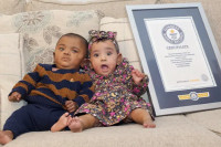 Најраније пријевремено рођени близанци у Гинисовој књизи рекорда