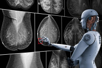 Развијена вјештачка интелигенција која открива рак дојке