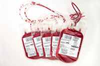 Jezero: Prikupljeno 17 doza krvi
