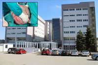 UKC: Prijedorčanki uspješno odstranjen tumor težak oko 23 kilograma