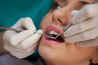 "Нијемци ће отварати ординације у Бањалуци": Познати љекар тврди да стижу страни стоматолози