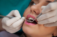 Evo koje stomatološke usluge možete dobiti na račun FZO Srpske