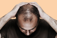 Ako naglo gubite kosu, ovo je pet glavnih razloga zašto vam se to događa