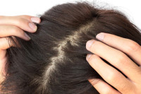 Pet efikasnih trikova za brži rast kose
